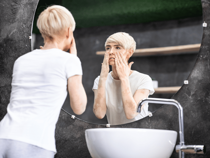 woman checking skin for signs of stripping