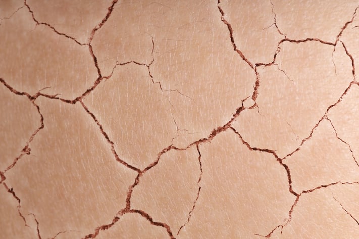 close up of cracked ground